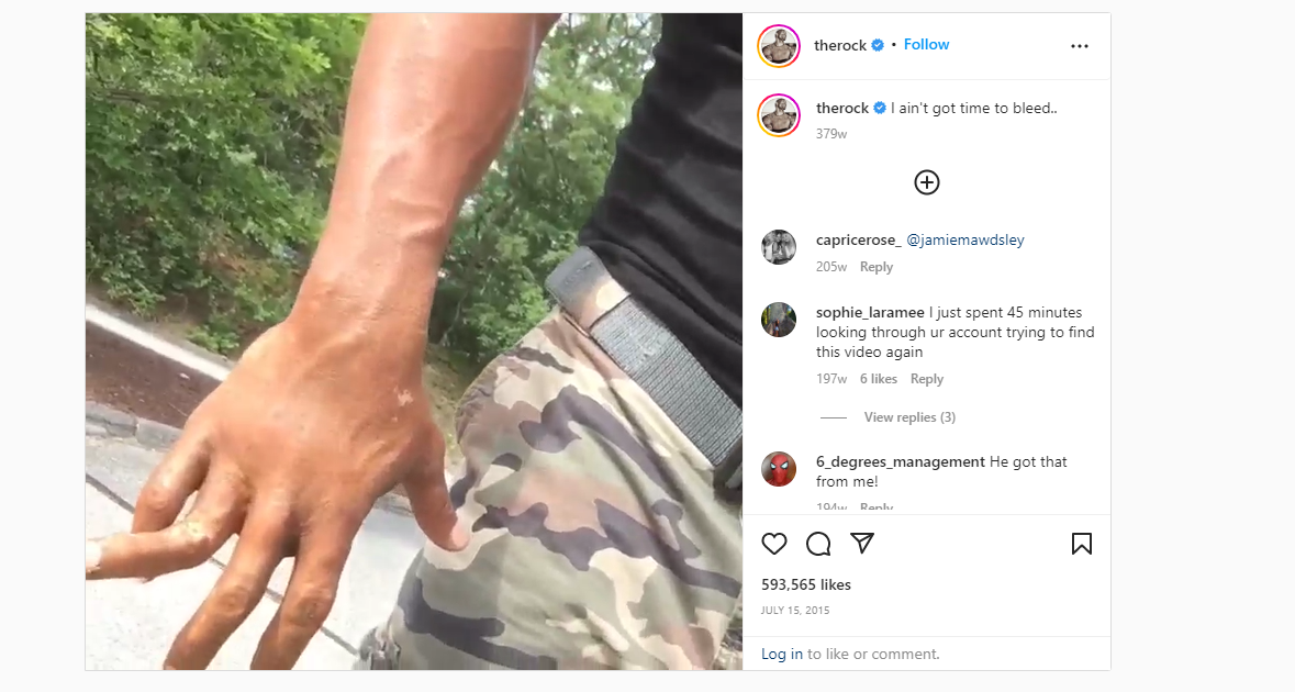 A screenshot of Dwayne "The Rock" Johnson's broken finger.