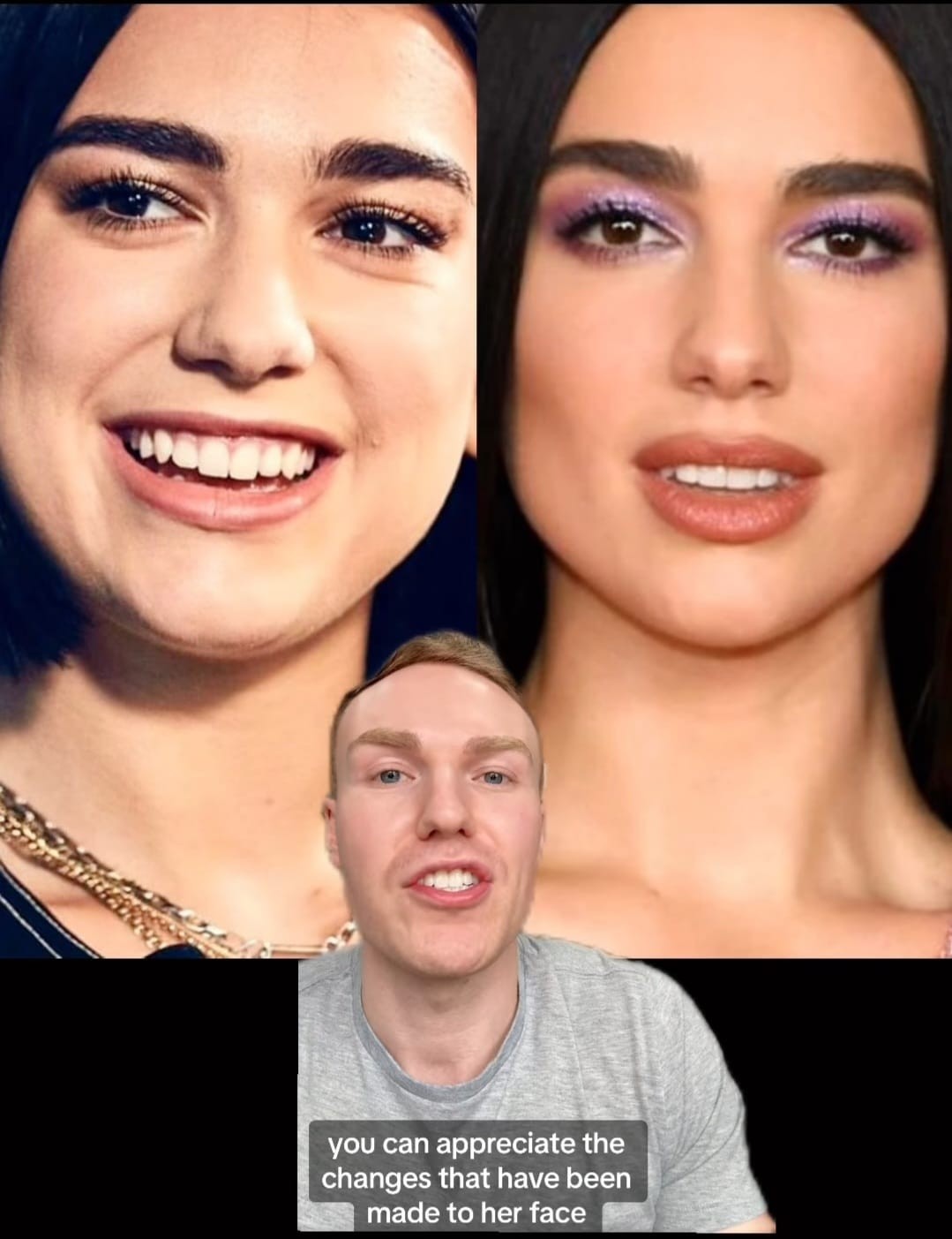 Before and after images of Dua Lipa