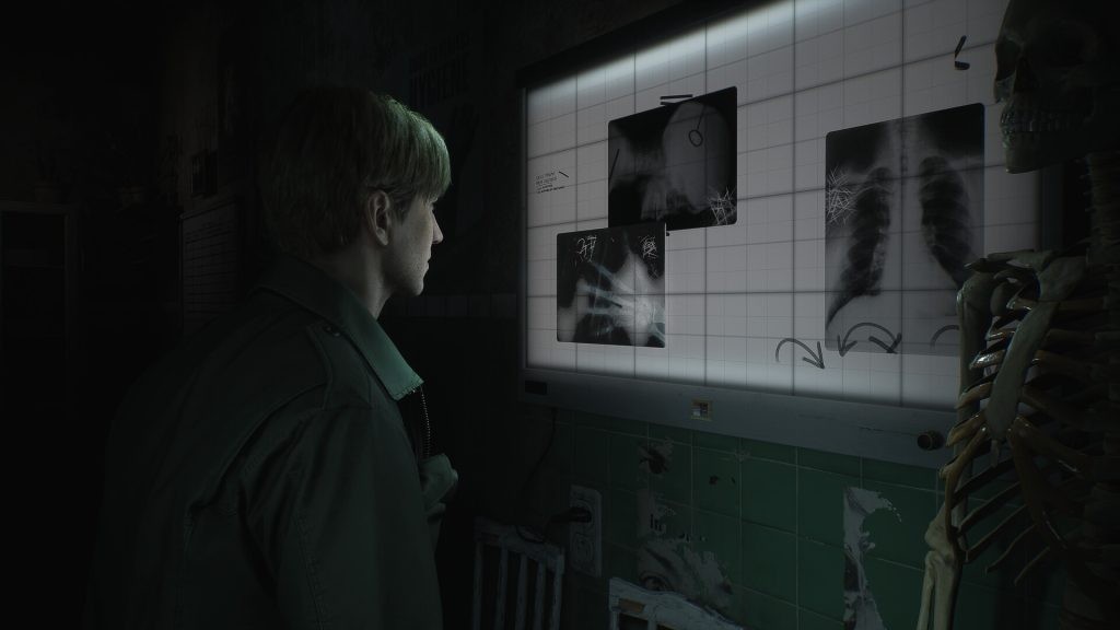 Gamers are concerned that the quality of the Silent Hill 2 trailer could be the final result, even after assurance from Konami.