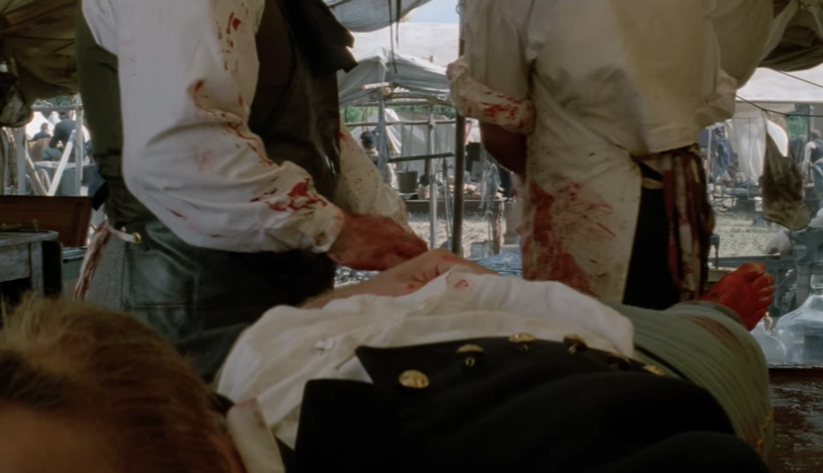 Leg amputation scene in Dances with Wolves