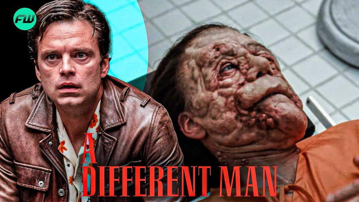 A Different Man Review – Sebastian Stan is Extraordinary in this Surreal Dark Comedy