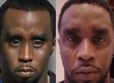 They Have a Diddy’s Clone?- Before and After Pictures of Diddy’s Face Have Given the Wrong Ideas to Fans