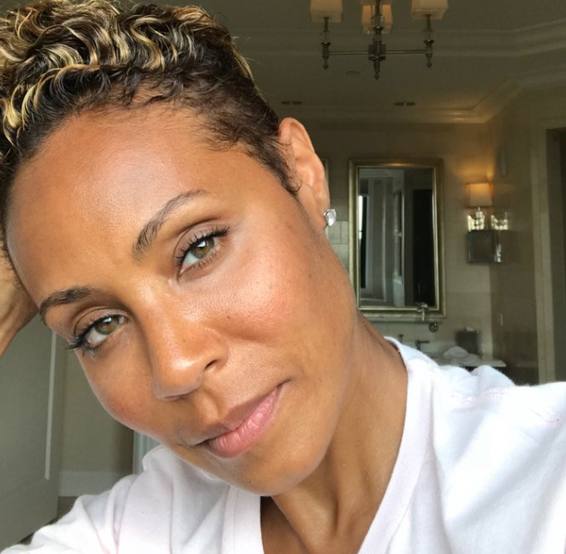 What Is Alopecia Areata? Jada Pinkett Smith Suffers from This Autoimmune Disorder Since 2018