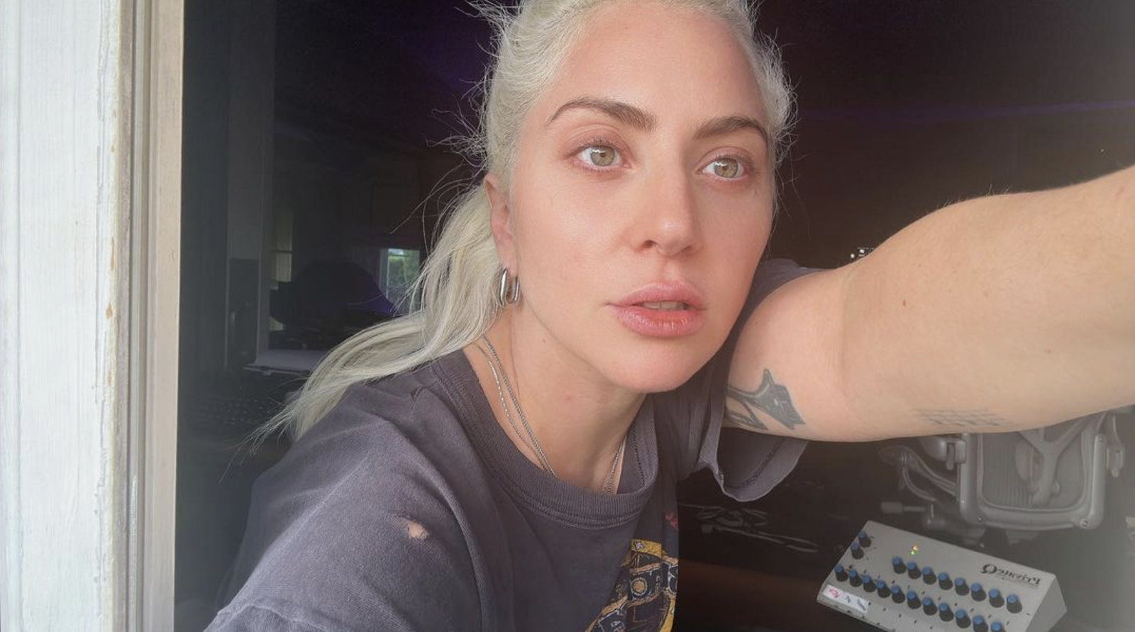 What Is Fibromyalgia? Lady Gaga Kept Her Fight Against This Incurable Disease a Secret for Years