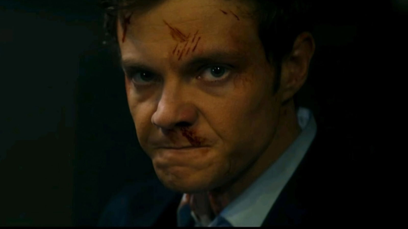 Jack Quaid Couldn’t Really Hide His Swollen Nose While Working With Jennifer Lawrence in ‘The Hunger Games’