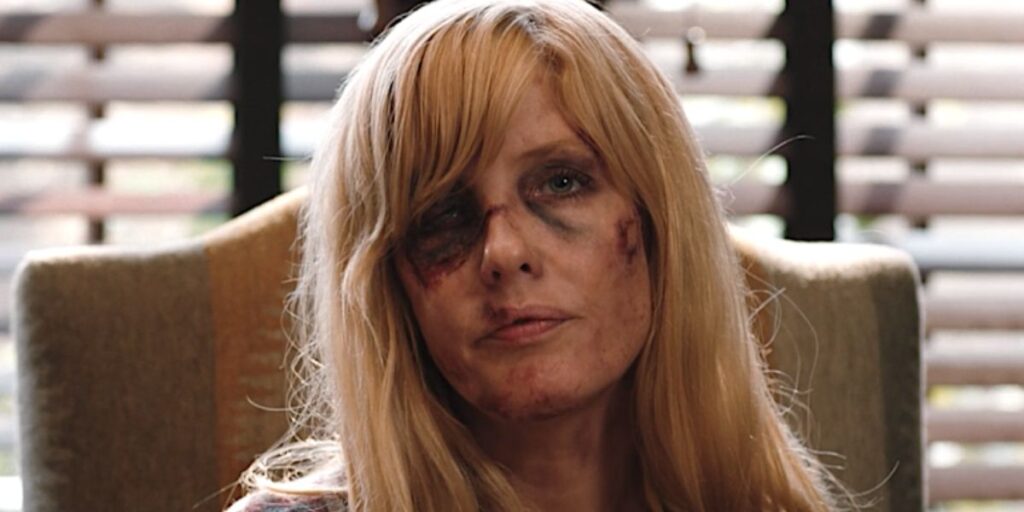 Close up of Kelly Reilly as Beth Dutton bruised and beaten in Yellowstone