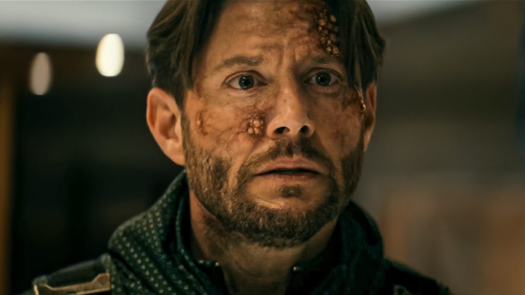 soldier boy infected with supe killing virus in the boys season 5 episode 2