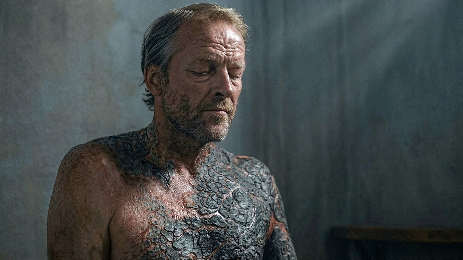 Every Unique Disease In Game of Thrones, Ranked