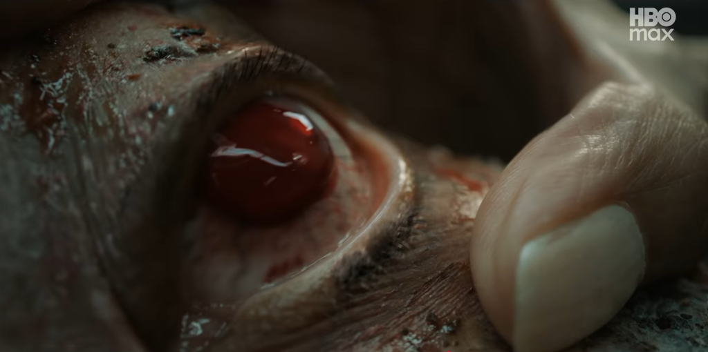 Extreme close-up of an eye pooled entirely with blood or another red liquid, as a finger reaches in to examine it.